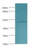 Serpin Family H Member 1 antibody, MBS1496278, MyBioSource, Western Blot image 