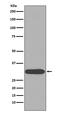 Cyclin Dependent Kinase 1 antibody, M00209-2, Boster Biological Technology, Western Blot image 