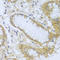 Acid Phosphatase 1 antibody, A02167, Boster Biological Technology, Immunohistochemistry frozen image 