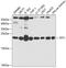 Tumor Protein, Translationally-Controlled 1 antibody, GTX32916, GeneTex, Western Blot image 
