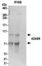 ADAM Metallopeptidase Domain 9 antibody, NBP2-32260, Novus Biologicals, Immunoprecipitation image 