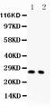Cyclin Dependent Kinase Inhibitor 1B antibody, LS-C343947, Lifespan Biosciences, Western Blot image 