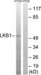 Serine/Threonine Kinase 11 antibody, LS-C199203, Lifespan Biosciences, Western Blot image 