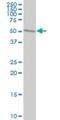 Tryptophanyl-TRNA Synthetase antibody, H00007453-M02, Novus Biologicals, Western Blot image 