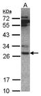 Proteasome Subunit Alpha 6 antibody, LS-C185682, Lifespan Biosciences, Western Blot image 