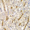 Par-6 Family Cell Polarity Regulator Alpha antibody, LS-C332344, Lifespan Biosciences, Immunohistochemistry paraffin image 
