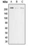 Cytochrome B-245 Alpha Chain antibody, orb215457, Biorbyt, Western Blot image 