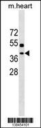 ER Membrane Protein Complex Subunit 2 antibody, 59-863, ProSci, Western Blot image 