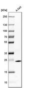 Glutathione S-Transferase Pi 1 antibody, HPA019779, Atlas Antibodies, Western Blot image 