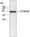 Serine/Threonine Kinase Receptor Associated Protein antibody, MBS851296, MyBioSource, Western Blot image 