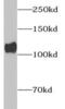 Collagen Type I Alpha 2 Chain antibody, FNab01836, FineTest, Western Blot image 