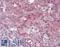 AKT Serine/Threonine Kinase 2 antibody, LS-B11820, Lifespan Biosciences, Immunohistochemistry frozen image 