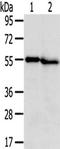 Transmembrane Serine Protease 5 antibody, TA350520, Origene, Western Blot image 