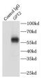 Glutamic--Pyruvic Transaminase 2 antibody, FNab03620, FineTest, Immunoprecipitation image 