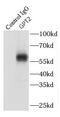 Alanine aminotransferase 2 antibody, FNab03620, FineTest, Immunoprecipitation image 