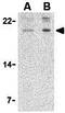 Amino-terminal enhancer of split antibody, GTX16983, GeneTex, Western Blot image 