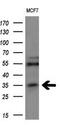 MAGE-3 antigen antibody, M03212, Boster Biological Technology, Western Blot image 