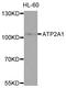 ATPase Sarcoplasmic/Endoplasmic Reticulum Ca2+ Transporting 1 antibody, STJ112143, St John