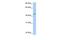 Patatin Like Phospholipase Domain Containing 5 antibody, GTX46144, GeneTex, Western Blot image 