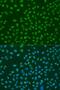 ELAV Like RNA Binding Protein 1 antibody, LS-C746848, Lifespan Biosciences, Immunofluorescence image 
