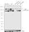 GLI Family Zinc Finger 2 antibody, 711045, Invitrogen Antibodies, Western Blot image 