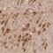 Diphosphoinositol Pentakisphosphate Kinase 2 antibody, NBP2-38368, Novus Biologicals, Immunohistochemistry paraffin image 