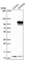 ADAM Metallopeptidase Domain 32 antibody, NBP1-86198, Novus Biologicals, Western Blot image 