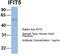 Interferon Induced Protein With Tetratricopeptide Repeats 5 antibody, TA334459, Origene, Western Blot image 