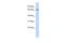 Zinc Finger Protein 503 antibody, A12892, Boster Biological Technology, Western Blot image 