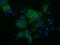 Kelch Like Family Member 2 antibody, MA5-25221, Invitrogen Antibodies, Immunocytochemistry image 