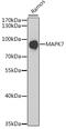 Mitogen-Activated Protein Kinase 7 antibody, 18-510, ProSci, Western Blot image 