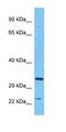 Histone H3 Associated Protein Kinase antibody, orb326351, Biorbyt, Western Blot image 