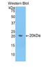 BCL2L2-PABPN1 Readthrough antibody, LS-C292975, Lifespan Biosciences, Western Blot image 