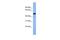 Serine/Threonine Kinase 25 antibody, PA5-69552, Invitrogen Antibodies, Western Blot image 