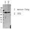 SMAD Family Member 3 antibody, STJ99595, St John