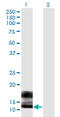 Small Proline Rich Protein 2F antibody, LS-C198256, Lifespan Biosciences, Western Blot image 