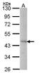 Dynein Axonemal Assembly Factor 4 antibody, PA5-28403, Invitrogen Antibodies, Western Blot image 