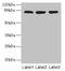 ArfGAP With Coiled-Coil, Ankyrin Repeat And PH Domains 1 antibody, CSB-PA622985EA01HU, Cusabio, Western Blot image 