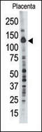 Protein Tyrosine Phosphatase Non-Receptor Type 21 antibody, AP15233PU-N, Origene, Western Blot image 