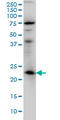 RAB3A, Member RAS Oncogene Family antibody, LS-C198045, Lifespan Biosciences, Western Blot image 