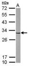 Cyclin Dependent Kinase 5 antibody, PA5-28795, Invitrogen Antibodies, Western Blot image 