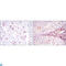 CD1a Molecule antibody, LS-C812527, Lifespan Biosciences, Immunofluorescence image 