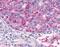 Adhesion G Protein-Coupled Receptor A2 antibody, NLS2171, Novus Biologicals, Immunohistochemistry frozen image 