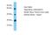 Chondroitin Sulfate N-Acetylgalactosaminyltransferase 2 antibody, PA5-43328, Invitrogen Antibodies, Western Blot image 