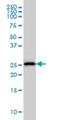 Major Histocompatibility Complex, Class II, DM Alpha antibody, H00003108-M01, Novus Biologicals, Western Blot image 