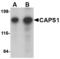 Calcium Dependent Secretion Activator antibody, TA306561, Origene, Western Blot image 
