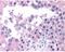 ATM Serine/Threonine Kinase antibody, GTX30104, GeneTex, Immunohistochemistry paraffin image 