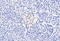 Cholecystokinin B Receptor antibody, 45-378, ProSci, Western Blot image 