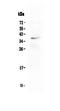 Oxidized Low Density Lipoprotein Receptor 1 antibody, A00760-1, Boster Biological Technology, Western Blot image 