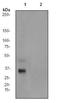 Activating Transcription Factor 1 antibody, GTX62032, GeneTex, Western Blot image 